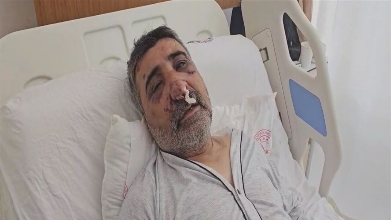 ingiliz boksorun dovdugu taksici konustu optu isirdi elini gozume soktu EIZJNgGu