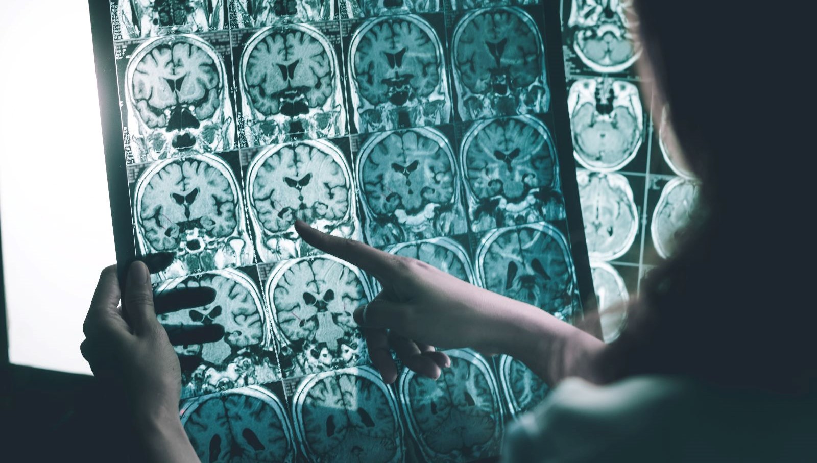 beynine cip takilan als hastasi muzik soylemeye basladi n6LugOQn