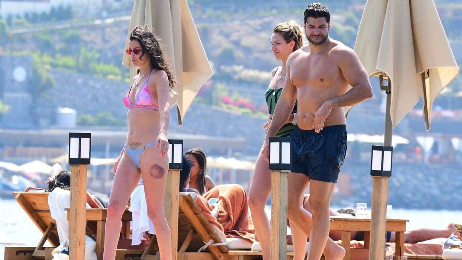 mujde uzman bodrum tatilinde objektiflere takildi bacagindaki morluk dikkat cekti BfJAfQ5s