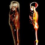 en eski dna cikarildi her seyi iki dis anlatiyor 1hAEgdCt