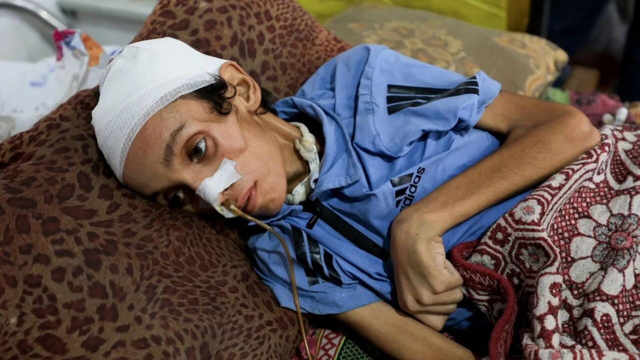 gazzede aclik krizi abluka altinda yavas isleyen bir kitlik cinayeti nl9AyKTt