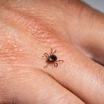 kene isiriklarina karsi altin kural hemen cikarin d6DuB2Wg