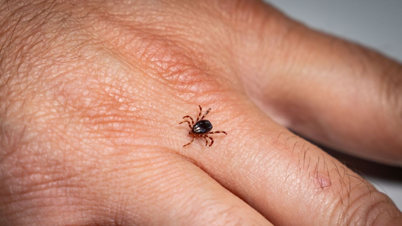 kene isiriklarina karsi altin kural hemen cikarin d6DuB2Wg