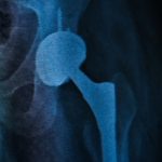 dort yillik agrili yasam tek ameliyatla bitti QGMDrjPc