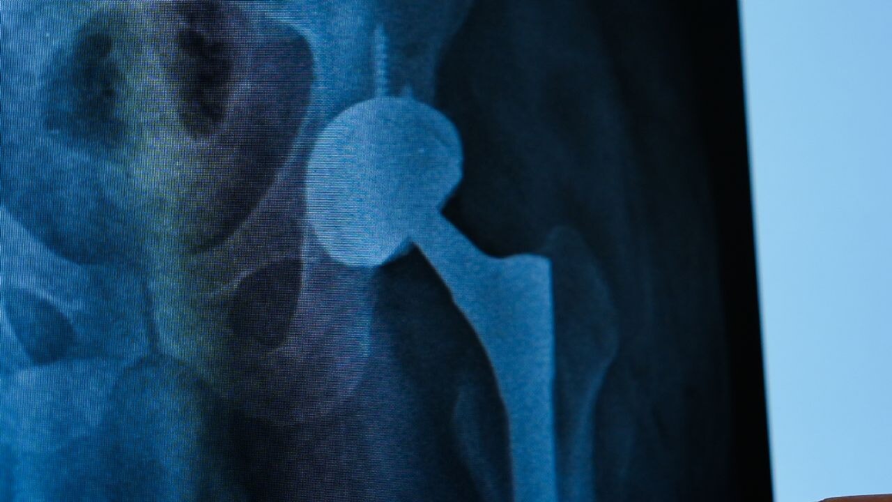 dort yillik agrili yasam tek ameliyatla bitti QGMDrjPc