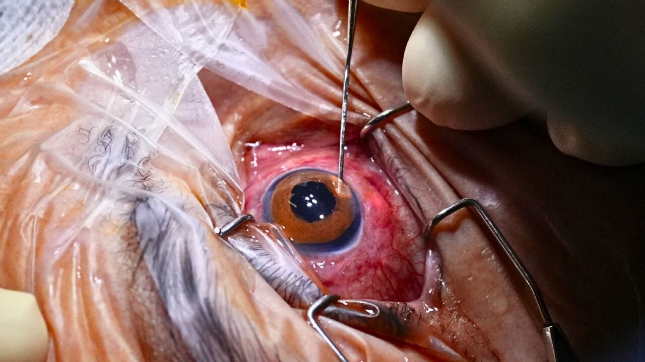 goz dovmesi kararan gozune isik oldu KdZmG9Aj