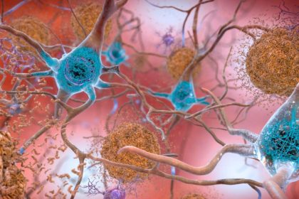 arastirmacilardan alzheimera karsi yeni formul shield nedir IFOtzUXH
