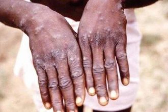 ganada m cicegi hadise sayisi 565e cikti i2NLNl4M