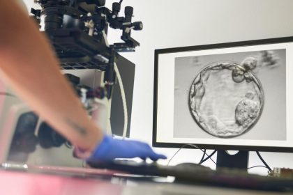 tipta bir birinci insan derisinden yumurta hucresi uretildi ZL2yuQ5K