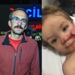 baskentte pitbull dehseti iki kardes yaralandi birinin yuzu parcalandi uc8IVxMY