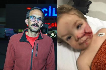 baskentte pitbull dehseti iki kardes yaralandi birinin yuzu parcalandi uc8IVxMY