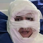 genc bayanin yuzune yanici unsur dokup atese verdi kuskulu bayan tutuklandi 6saZYgKc