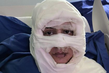 genc bayanin yuzune yanici unsur dokup atese verdi kuskulu bayan tutuklandi 6saZYgKc