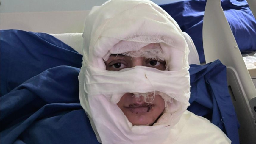 genc bayanin yuzune yanici unsur dokup atese verdi kuskulu bayan tutuklandi 6saZYgKc