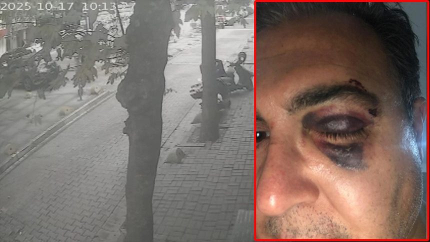 Kedi besleyen iş insanına "Yolu kapattın" dayağı 71 kedi besleyen is insanina yolu kapattin dayagi 193xql1D