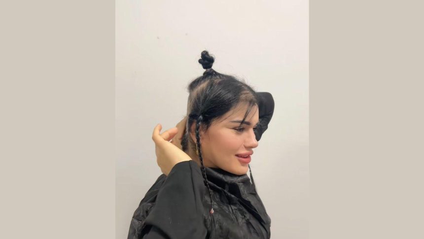 tiktok fenomeni hulya mizginin saclari estetik kurbani 6qw3Ogll