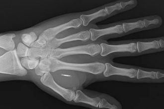 bedenine yerlestirdigi cipin sifresini unuttu nZ3Ypb5A