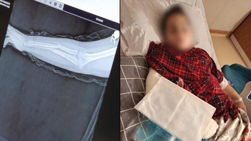 Okulda akran zorbalığı. 9 yaşındaki çocuk arkadaşının kolunu kırdı 69 okulda akran zorbaligi 9 yasindaki cocuk arkadasinin kolunu kirdi WjHZed4p