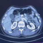 uc iranli rontgene girince yakayi ele verdi JY7eEjSv