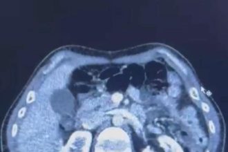 uc iranli rontgene girince yakayi ele verdi JY7eEjSv