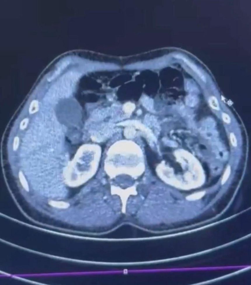 Üç İranlı röntgene girince yakayı ele verdi 71 uc iranli rontgene girince yakayi ele verdi JY7eEjSv